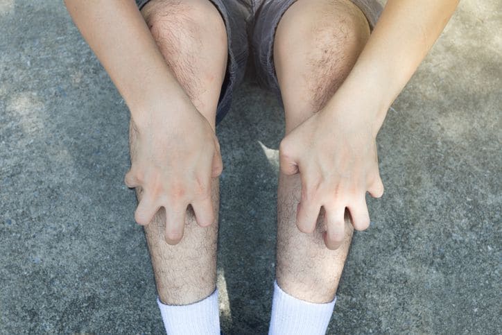 Itchy Legs Causes, Treatment, And Prevention