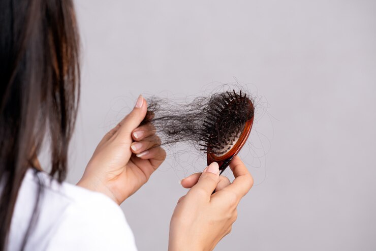 woman-hair-loss-hair_fall-brush