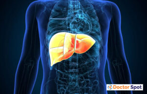 fatty-liver