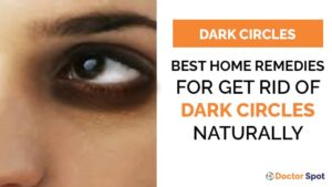 Best Home Remedies for Get Rid of Dark Circles Naturally