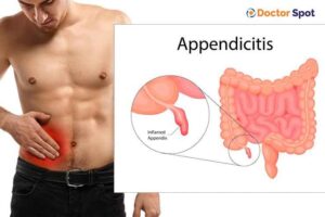 Appendicitis