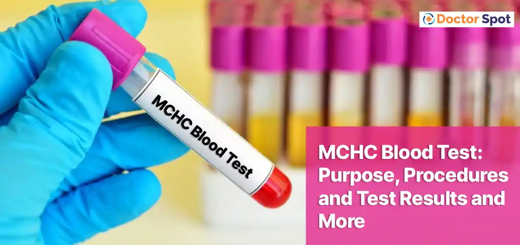 MCHC Blood Test -DOCTORSPOT
