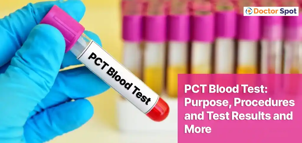 PCT Blood Test Purpose, Procedures and Test Results and More - Doctorspot.in