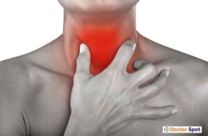 sore throat -doctorspot