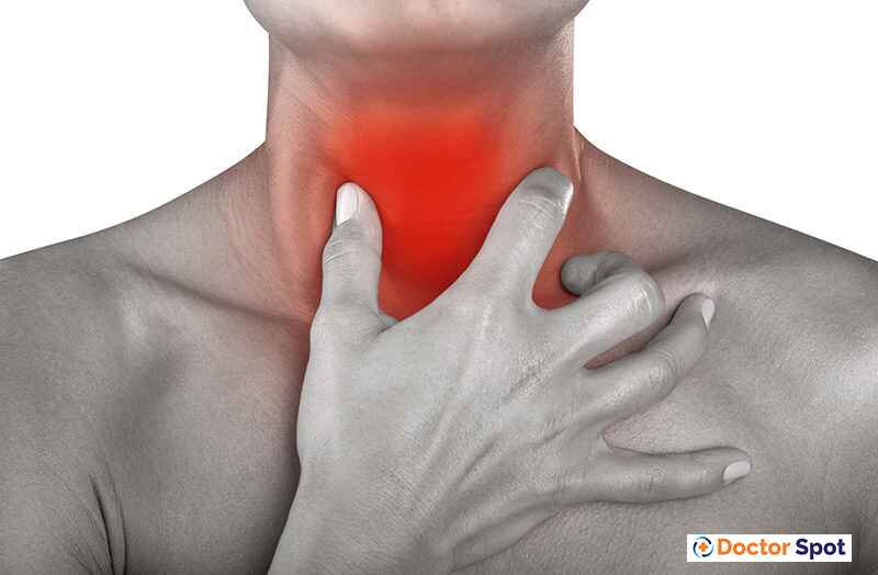 sore throat -doctorspot