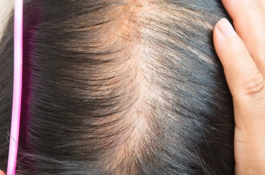 Bad Habits That Cause Your Hair to Thin