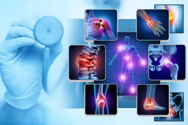 Managing Pain in Musculoskeletal Disorders