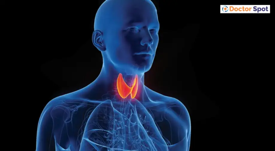 thyroid-cancer -doctorspot